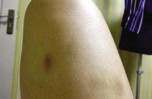 When the woman says to learn a car, meet with the coach is act indecently towards: Hand of ham of th