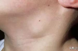 You think is suffer from excessive internal heat, 