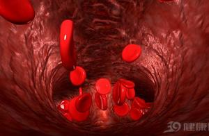 Be illogical painful: Blood-vessel jams, the body 