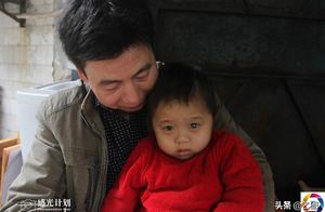 7 years old female child after contracting rare di