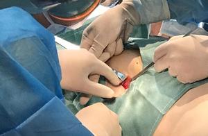 Be occupied by fish mediastinum when the doctor a pectoral water hind, him suspicion gets cancer, ho