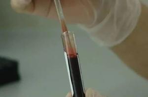 The fish inside man a week 3 kinds of cancer! The 