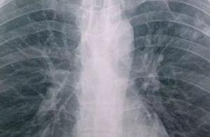 Commit murder in the street, only serve a sentence