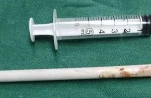 Too dangerous! 6 years old male child fall carelessly, pencil takes an eye from different face jab..