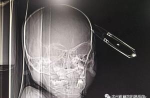 Bank one child of many years old 2 takes the administrative division scissors plays, fall carelessly