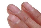 手指头的月牙真的可以看出自己的健康水平吗？