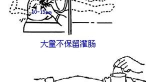 灌肠疼哭了作文