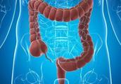 Man bellyacke, fish bowel cancer is terminal! Doctor: A kind of symptom appears, do not hesitate to