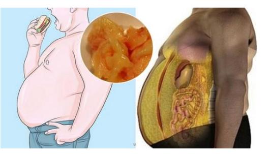 内脏脂肪指数(VAI)为高尿酸血症(HU - 今日头条